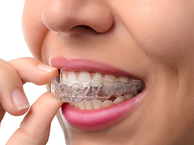 The image shows a person with clear braces on their teeth, holding up a finger in front of their mouth while looking at something off-camera.