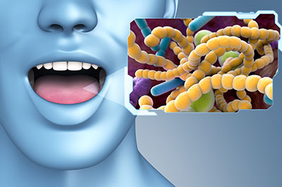 An illustration of a human mouth with an open tongue, displaying a microscopic view of bacteria and viruses, set against a blue background.