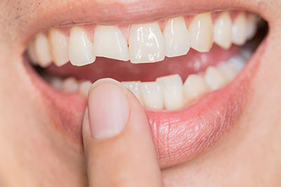 The image shows a close-up of a person s smiling face with teeth, holding a finger near their mouth, which appears to be brushing their teeth, with the focus on the teeth and the action of cleaning them.