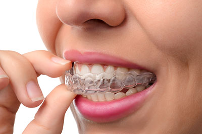 The image shows a person with clear braces, smiling while holding a toothpaste tube close to their mouth.