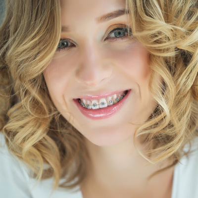A woman with straight teeth and braces, smiling at the camera, wearing a white top and curly hair, against a white background.