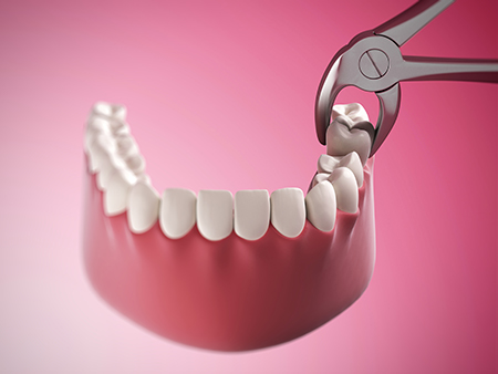 Middle Village Dental Group